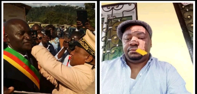 LE SCANDALEUX GESTIONNAIRE DE BIWONG BANE : Joseph Liboire Angono, un Maire aux méthodes honteuses Acte 1.